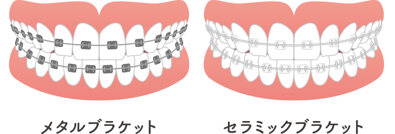 矯正歯科